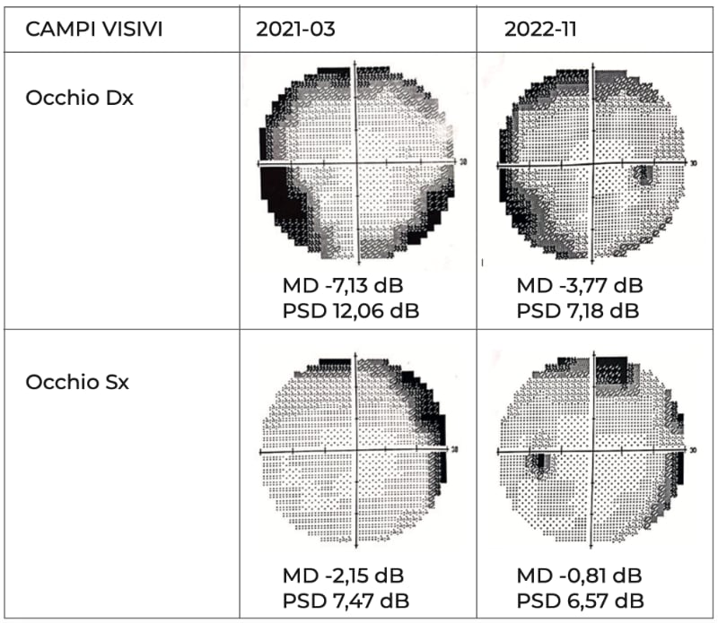 campi visivi